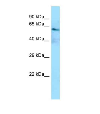 Delta3 / DLL3 Antibody (aa451-500)