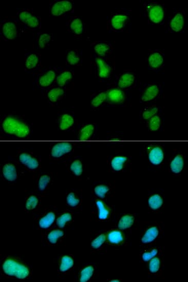 KDM1A / LSD1 Antibody