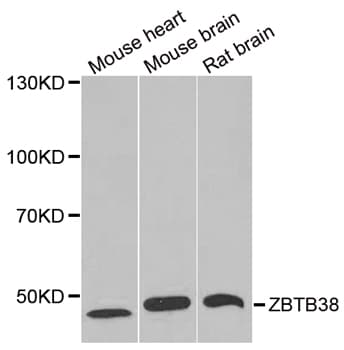 ZBTB38 Antibody