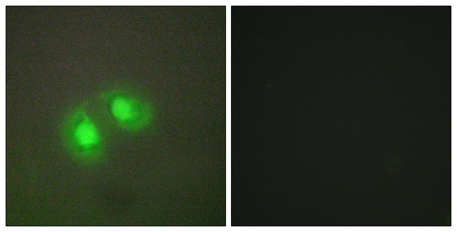 Polyclonal Rabbit anti-Human TOP2A / Topoisomerase II Alpha Antibody (IHC, IF, WB)