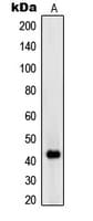 Polyclonal Rabbit anti-Human RIMKLA Antibody (Internal, WB)