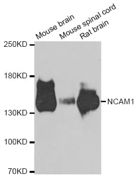 PathPlus™ Polyclonal Rabbit anti-Human NCAM / CD56 Antibody (aa759-858, IHC, WB)