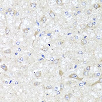 IHC-plus™ Polyclonal Rabbit anti-Human IL-33 Antibody (IHC, WB)