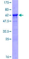 Human ARG1 / Arginase 1 Protein (Recombinant GST)