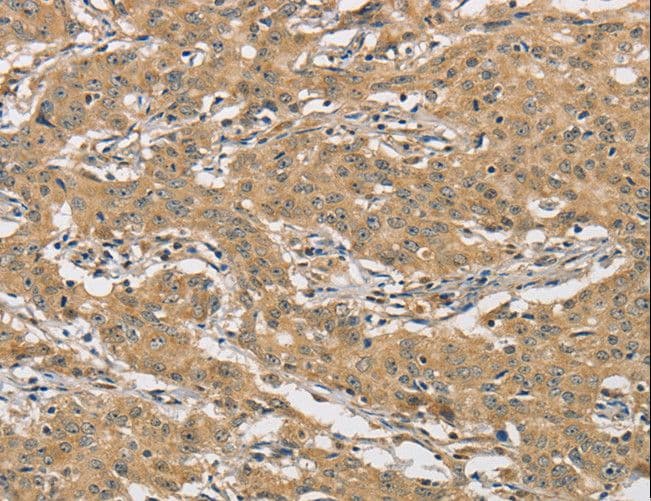 Polyclonal Rabbit anti-Human AMZ2 Antibody (IHC)