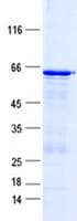 Human TBC1D3 / TBC1D3A Protein (Recombinant His, N-Terminal)