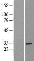 SPIC Protein (Over-Expression Lysate Myc-DDK (Flag))