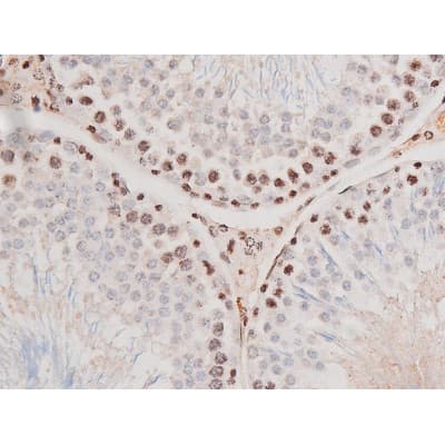STAT3 Antibody (phospho-Tyr705)