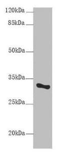 Polyclonal Rabbit anti-Human SNRPA / U1A Antibody (IHC, WB)