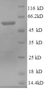 Human NT5C1A / CN1A Protein (Recombinant 6His, N-terminus)