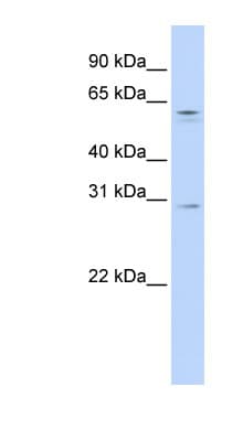 REC8 Antibody (aa72-121)