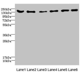 ADGRG6 / GPR126 Antibody