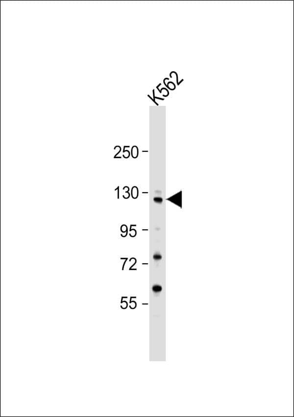 COL19A1 / Collagen XIX Antibody