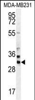 Polyclonal Rabbit anti-Human ZNF816 / ZNF816A Antibody (aa 1-30, N-term, IHC, WB)