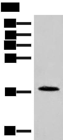 NOLA2 Antibody