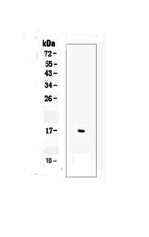 TNF Alpha Antibody