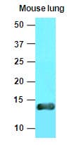 VAMP3 / VAMP-3 Antibody (aa1-77, clone K2A2)