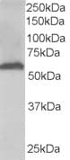 IHC-plus™ Polyclonal Goat anti-Human FTCD / 58K Golgi Protein Antibody (aa2-17, IHC, WB)