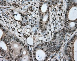 Basigin / Emmprin / CD147 Antibody (clone OTI3E5)