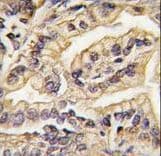 CSF1R / CD115 / FMS Antibody (aa940-971)