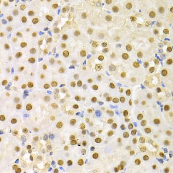 SFN / Stratifin / 14-3-3 Sigma Antibody