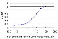 MSR1 / CD204 Antibody (clone 2G8)