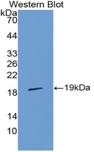 Polyclonal Rabbit anti-Human IL36RN / IL1F5 Antibody (Cy3, aa12-151, WB)