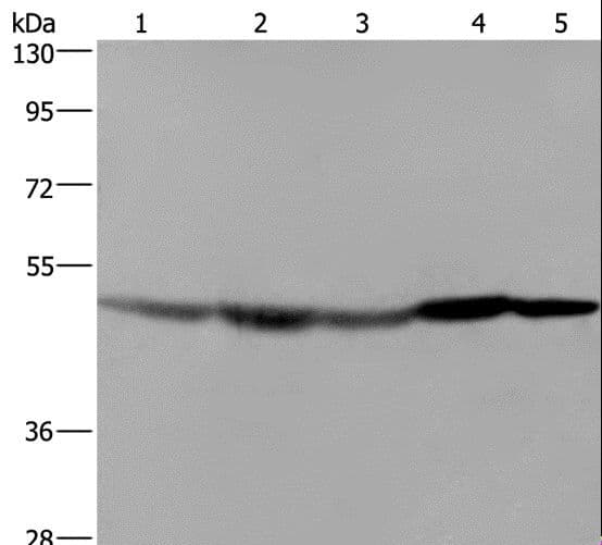Polyclonal Rabbit anti-Human FH / Fumarase / MCL Antibody (IHC, WB)