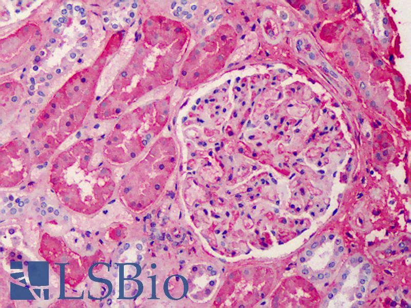 IHC-plus™ Polyclonal Goat anti-Human APOA1 / Apolipoprotein A 1 Antibody (IHC, WB)