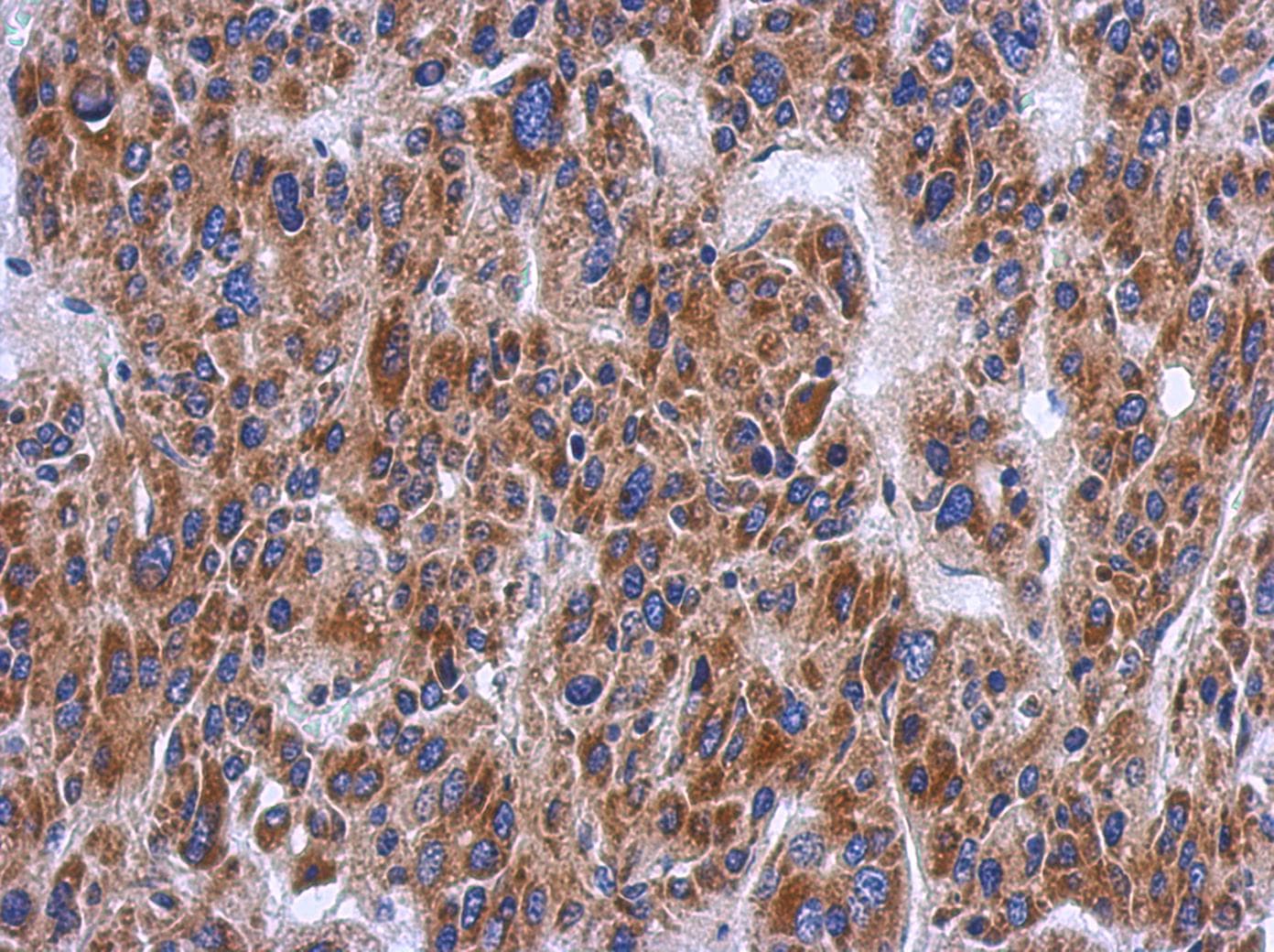 Polyclonal Rabbit anti-Human PTS Antibody (aa1-145, IHC, WB)