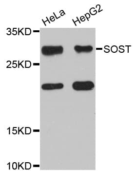 SOST / Sclerostin Antibody