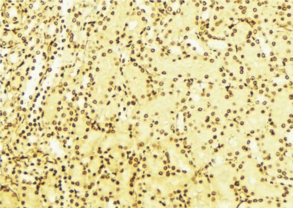 BAG1 / BAG-1 Antibody