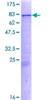 Human P450SCC / CYP11A1 Protein (Recombinant GST)