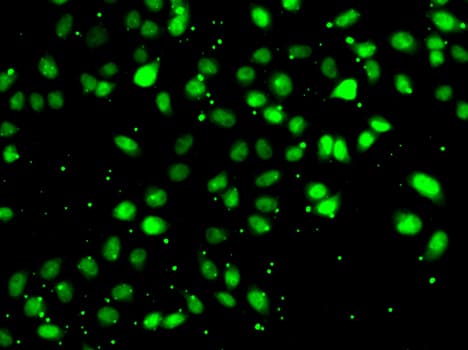 NUDT2 Antibody