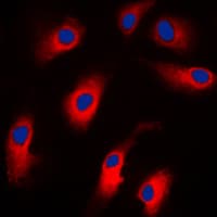 CASP7 / Caspase 7 Antibody (N-Terminus)