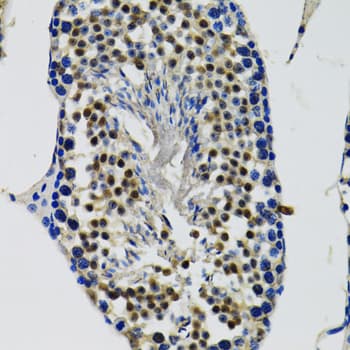 DDX41 / ABS Antibody