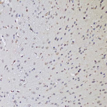 CTCF Antibody