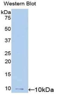 CCL20 / MIP-3-Alpha Antibody (aa27-96)