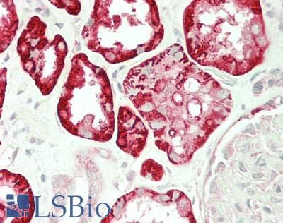 IHC-plus™ SLC4A4 / NBC1 Antibody