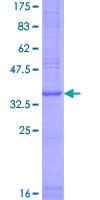 Human TMEM170A Protein (Recombinant GST)