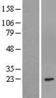 GSTM1 Protein (Over-Expression Lysate Myc-DDK (Flag))