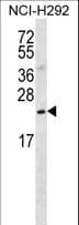 SLMO2 Antibody (aa92-121)