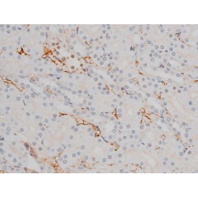 CREB1 / CREB Antibody (phospho-Ser133)