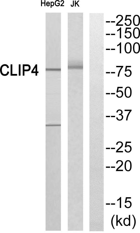 CLIP4 / RSNL2 Antibody