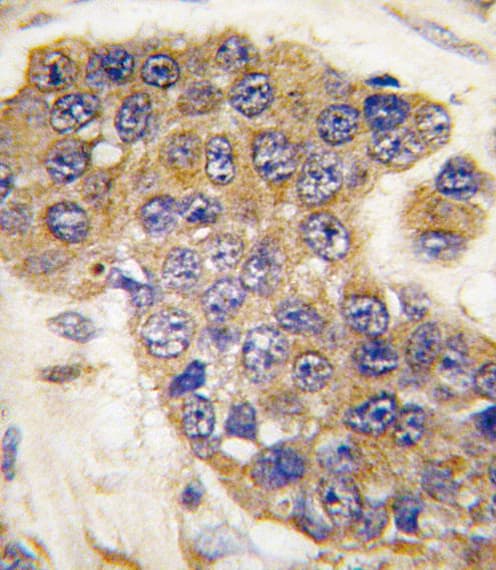 BBC3 / PUMA Antibody (aa119-154)