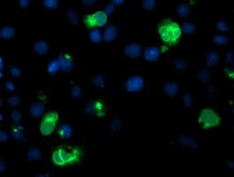 Monoclonal Mouse anti-Human LPL / Lipoprotein Lipase Antibody (clone OTI4F6, IHC, IF, WB)