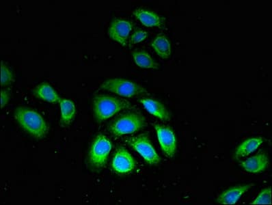 GPX4 / MCSP Antibody
