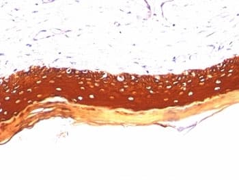 Acidic Cytokeratin Antibody (clone KRTL/1077)