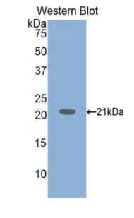 VWF / Von Willebrand Factor Antibody (Biotin)