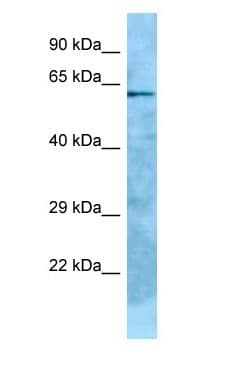 Polyclonal Rabbit anti-Human GPC2 / Glypican 2 Antibody (aa367-416, WB)